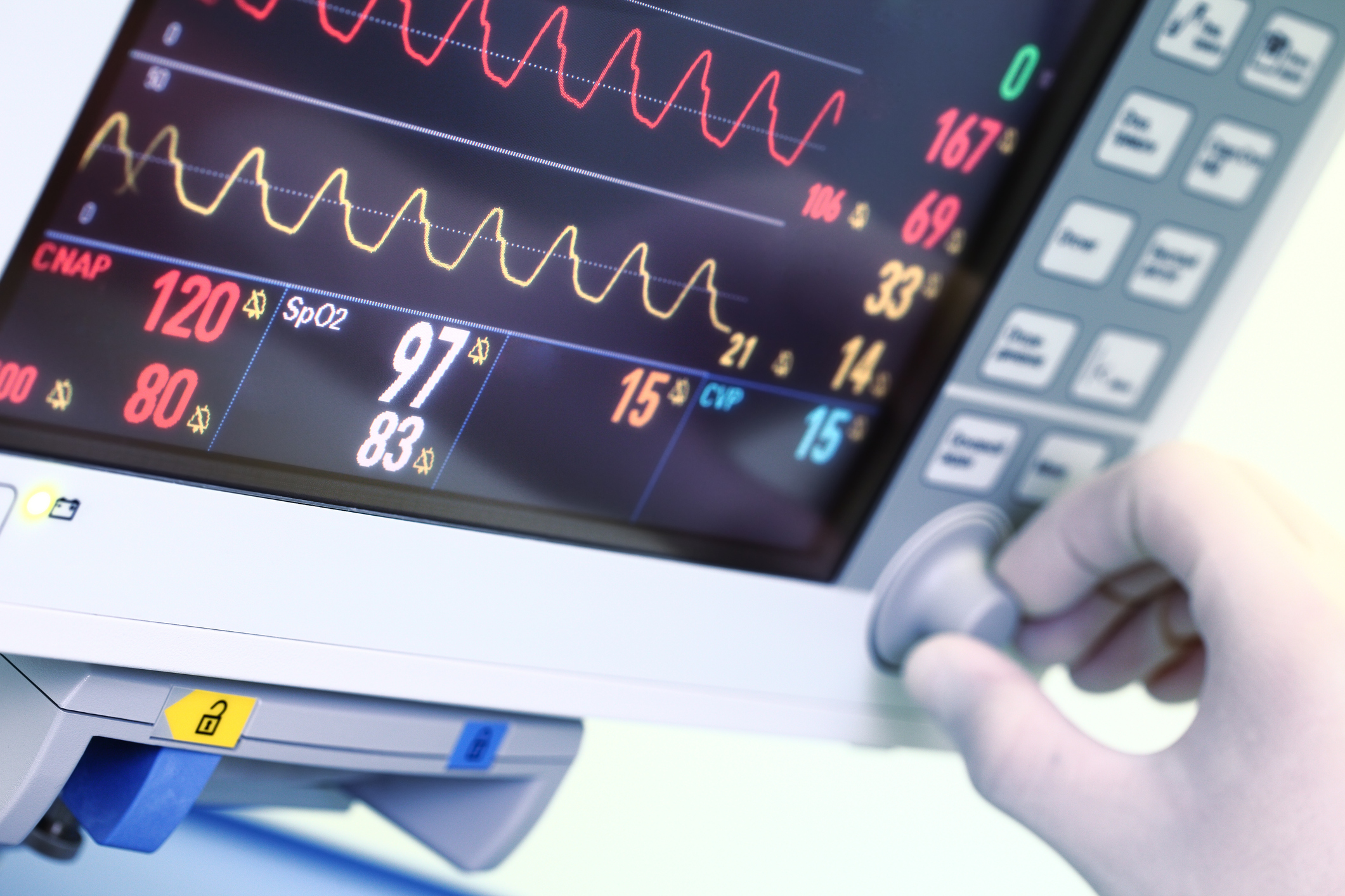 Picture of a heart monitor